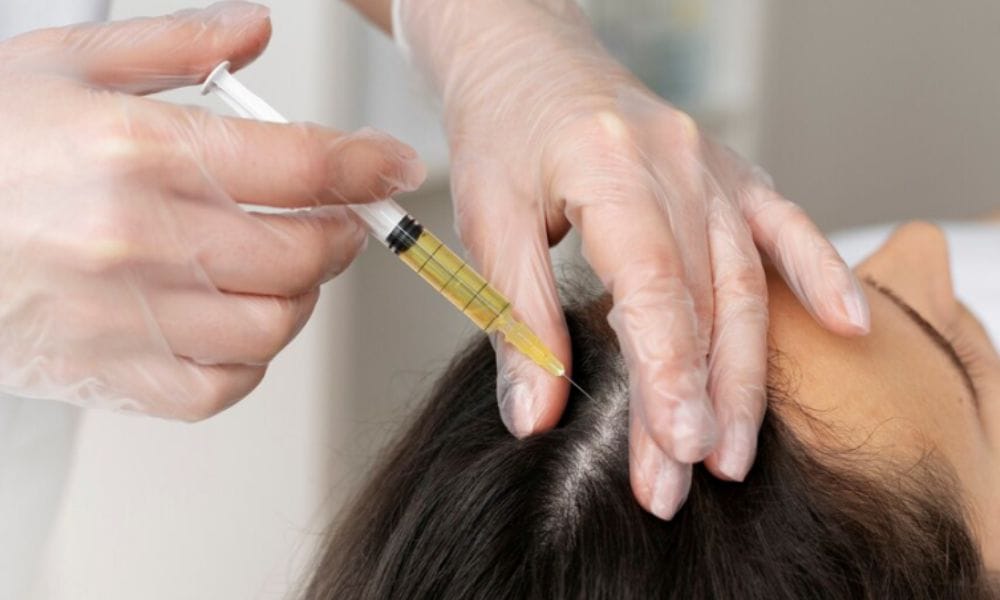 Haartransplantation Mannheim – Bart, Augenbrauen, PRP & Botox Fragen
