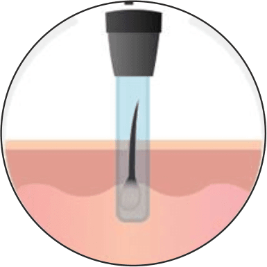 https://www.haartransplantationmannheim.com/wp-content/uploads/2025/06/haartransplantation-mannheim-1.png