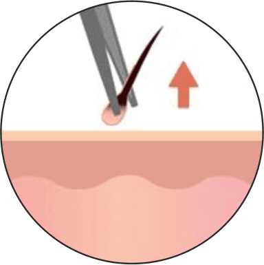https://www.haartransplantationmannheim.com/wp-content/uploads/2025/06/haartransplantation-mannheim-2.png