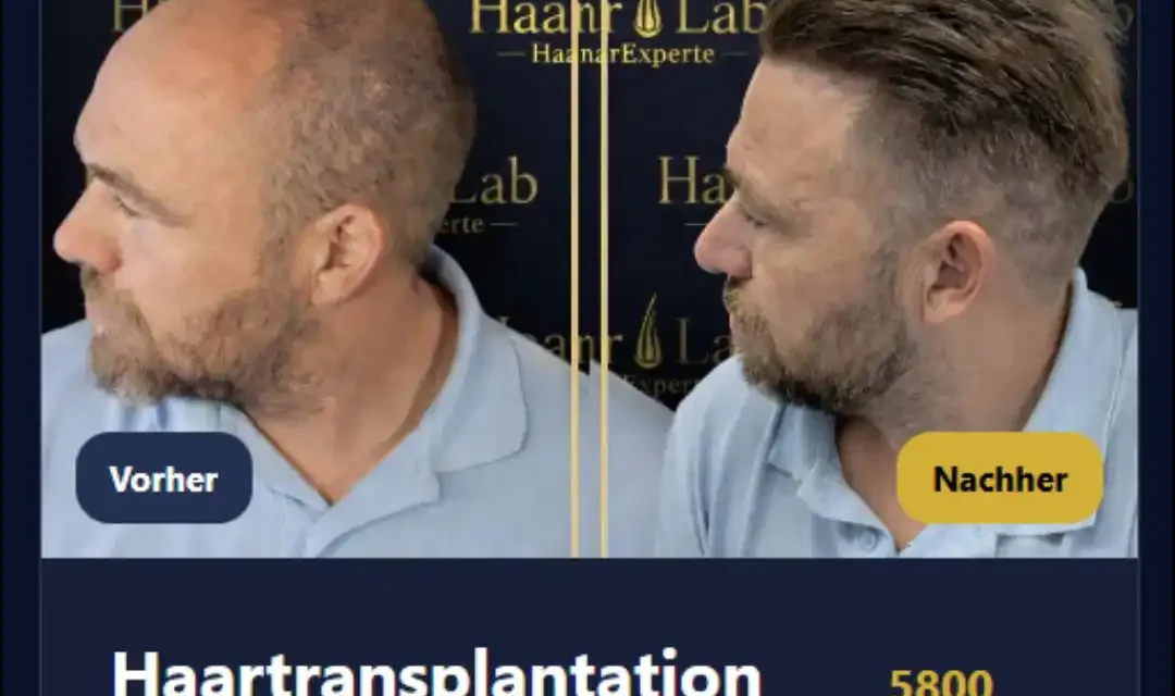 Haarklinik Deutschland – Ihr Spezialist für natürliches Haarwachstum